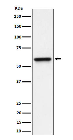 1 - Anti-RGS6 Rabbit Monoclonal Antibody ABO16366