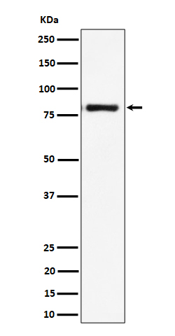 1 - Anti-LTK Rabbit Monoclonal Antibody ABO16367