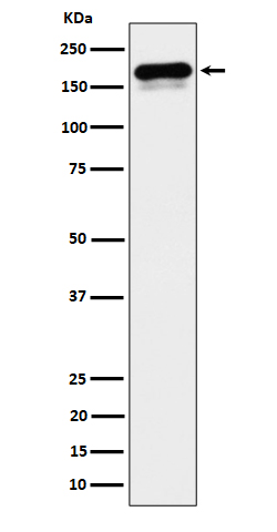 1 - Anti-CLIP170 Rabbit Monoclonal Antibody ABO16370