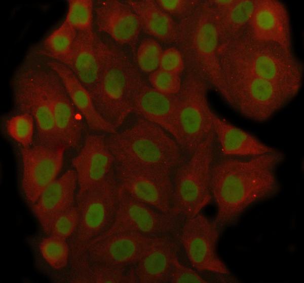 3 - Anti-RBM3 Rabbit Monoclonal Antibody ABO16372