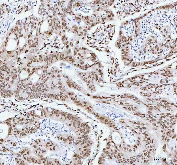 2 - Anti-RBM3 Rabbit Monoclonal Antibody ABO16372