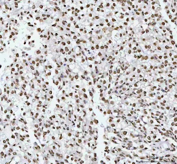 2 - Anti-RBM3 Rabbit Monoclonal Antibody ABO16372