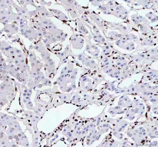 2 - Anti-RBM3 Rabbit Monoclonal Antibody ABO16372