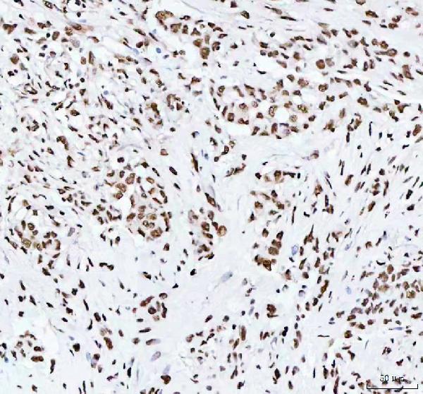 2 - Anti-RBM3 Rabbit Monoclonal Antibody ABO16372