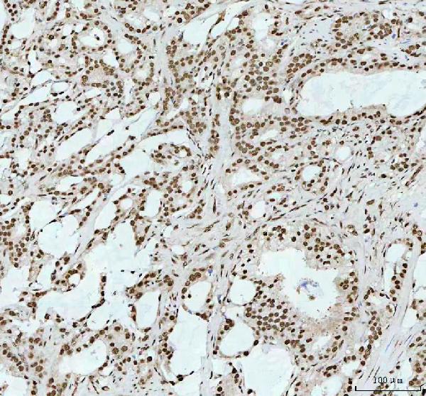 2 - Anti-RBM3 Rabbit Monoclonal Antibody ABO16372