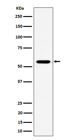 1 - Anti-RNF14 Rabbit Monoclonal Antibody ABO16374