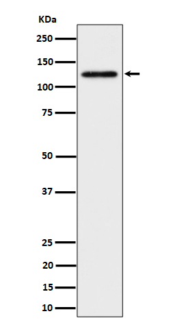 1 - Anti-SPINK5 / LEKTI Rabbit Monoclonal Antibody ABO16378