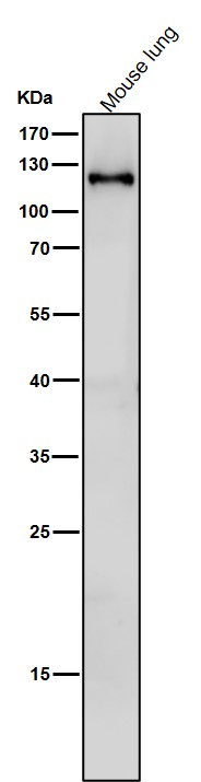 1 - Anti-SPINK5 / LEKTI Rabbit Monoclonal Antibody ABO16378