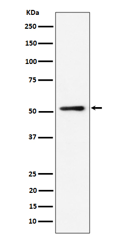 1 - Anti-NUP50 Rabbit Monoclonal Antibody ABO16380