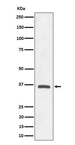 1 - Anti-OXGR1 / GPR99 Rabbit Monoclonal Antibody ABO16382