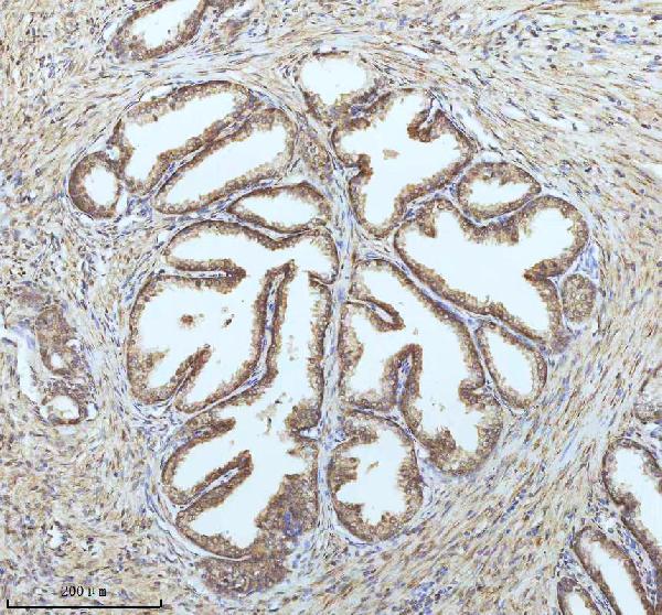 2 - Anti-PIN4 Rabbit Monoclonal Antibody ABO16383