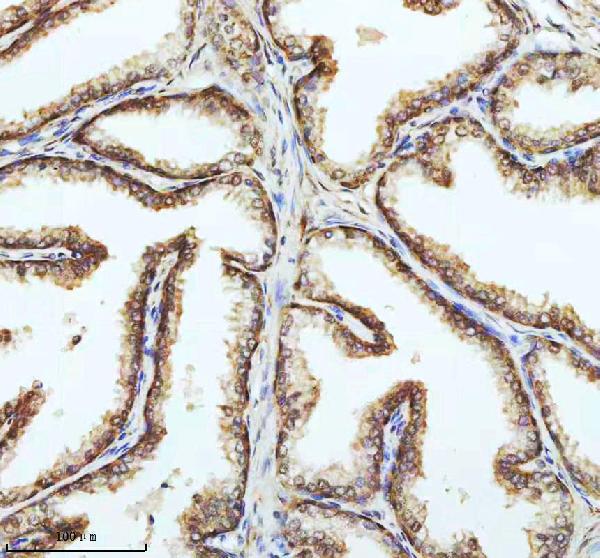 2 - Anti-PIN4 Rabbit Monoclonal Antibody ABO16383