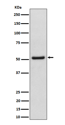 1 - Anti-NUP50 Rabbit Monoclonal Antibody ABO16384