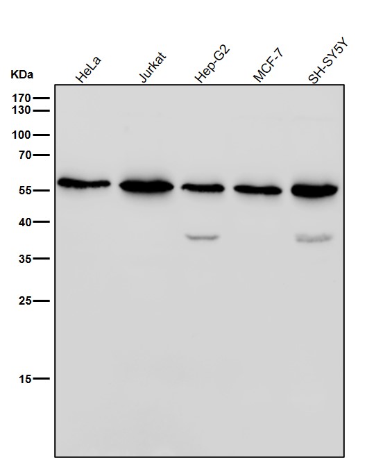 1 - Anti-NUP50 Rabbit Monoclonal Antibody ABO16384