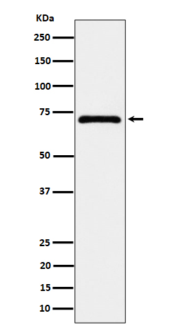 1 - Anti-EPHX2 Rabbit Monoclonal Antibody ABO16385