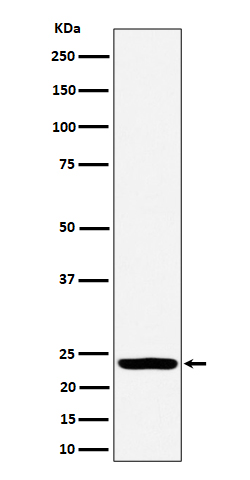 1 - Anti-DTYMK Rabbit Monoclonal Antibody ABO16386