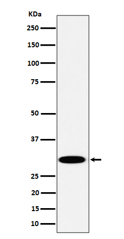 1 - Anti-TPMT Rabbit Monoclonal Antibody ABO16387