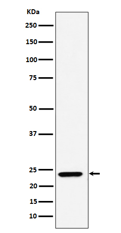 1 - Anti-DNAJC12 Rabbit Monoclonal Antibody ABO16388