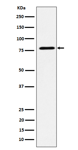 1 - Anti-EXOC3 Rabbit Monoclonal Antibody ABO16390