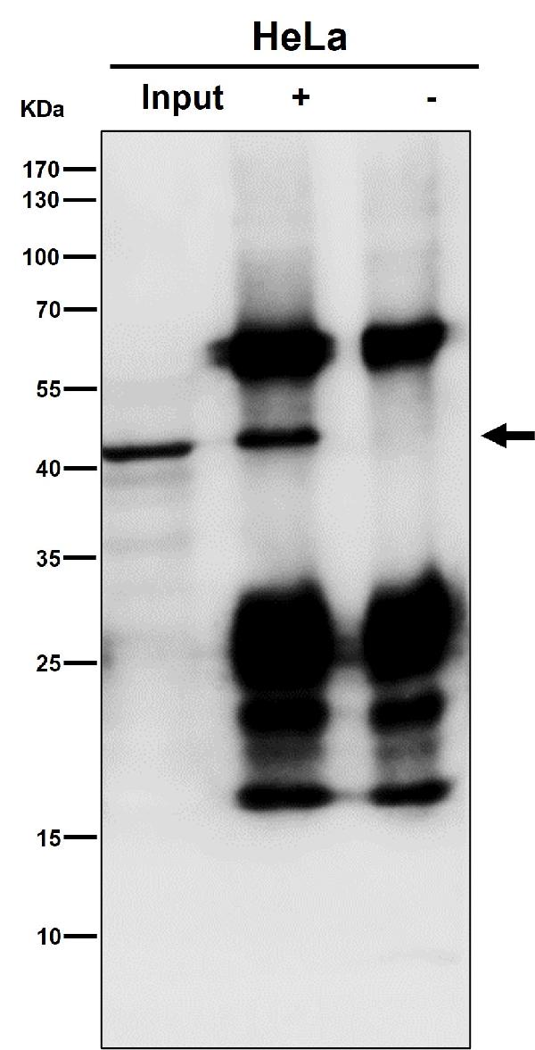 1 - Anti-ACADS / SCAD Rabbit Monoclonal Antibody ABO16391