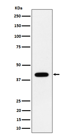 1 - Anti-ACADS / SCAD Rabbit Monoclonal Antibody ABO16391