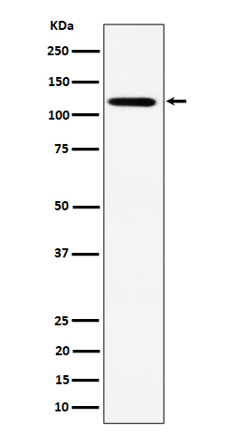 1 - Anti-KIF5B Rabbit Monoclonal Antibody ABO16394