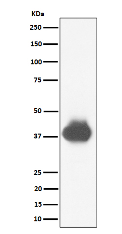 1 - Anti-CD32A + CD32B + CD32C Rabbit Monoclonal Antibody ABO16395