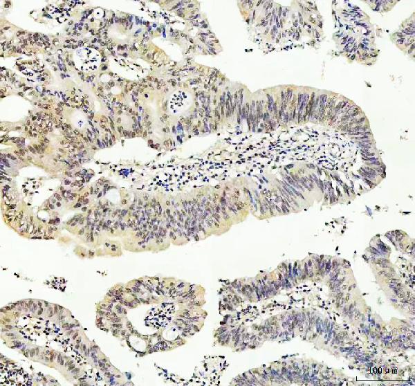 2 - Anti-JNK1 Rabbit Monoclonal Antibody ABO16398