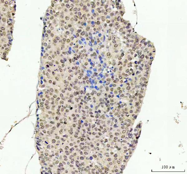 2 - Anti-JNK1 Rabbit Monoclonal Antibody ABO16398