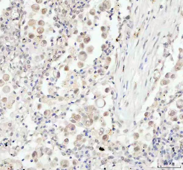 2 - Anti-JNK1 Rabbit Monoclonal Antibody ABO16398
