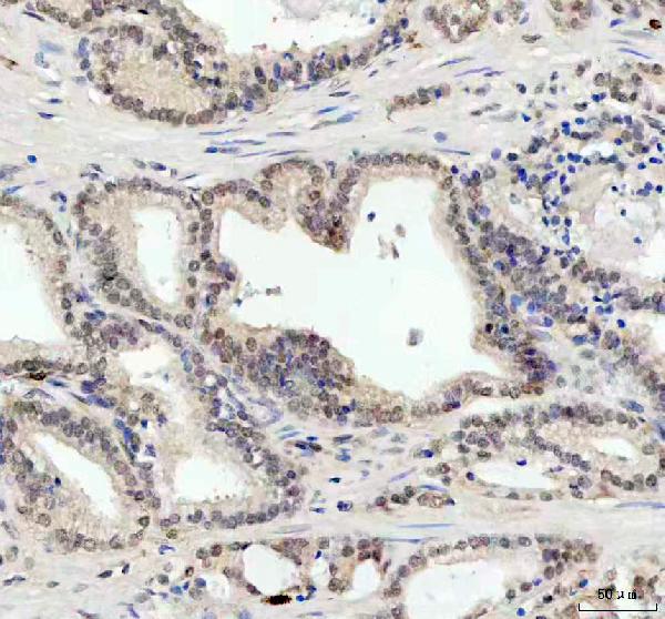 2 - Anti-JNK1 Rabbit Monoclonal Antibody ABO16398