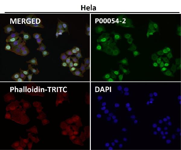1 - Anti-Phospho-MDM2 (S166) Rabbit Monoclonal Antibody ABO16399