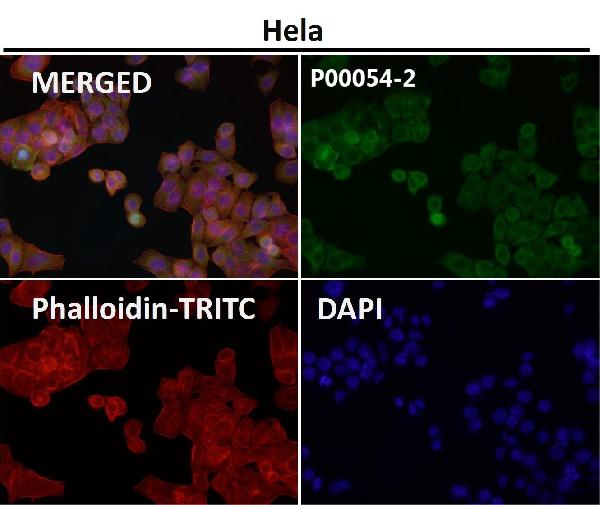 1 - Anti-Phospho-MDM2 (S166) Rabbit Monoclonal Antibody ABO16399