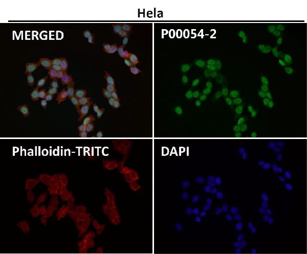 1 - Anti-Phospho-MDM2 (S166) Rabbit Monoclonal Antibody ABO16399
