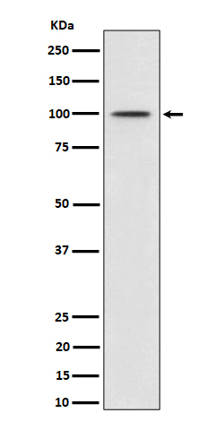 1 - Anti-Phospho-MDM2 (S166) Rabbit Monoclonal Antibody ABO16399