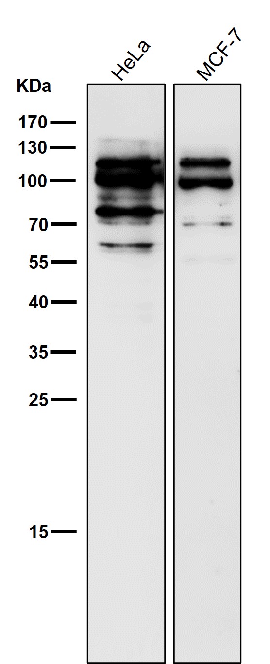 1 - Anti-Phospho-MDM2 (S166) Rabbit Monoclonal Antibody ABO16399