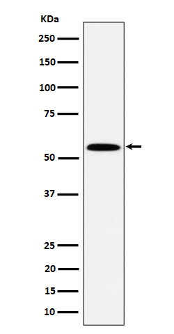 1 - Anti-PNK / PNKP Rabbit Monoclonal Antibody ABO16400