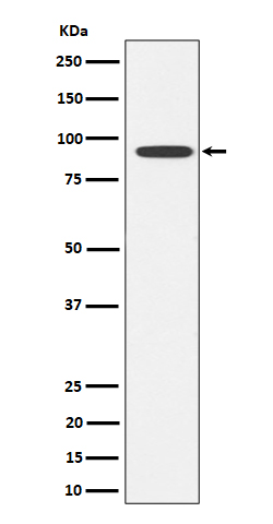 1 - Anti-Glyt2 Rabbit Monoclonal Antibody ABO16402