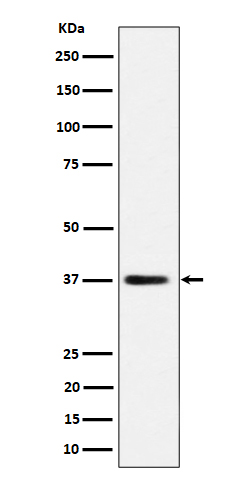 1 - Anti-MRPS31 Rabbit Monoclonal Antibody ABO16404