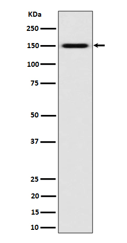 1 - Anti-SLC12A1 / NKCC2 Rabbit Monoclonal Antibody ABO16405
