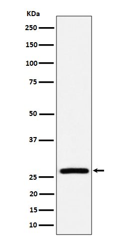 1 - Anti-AK2 Rabbit Monoclonal Antibody ABO16406