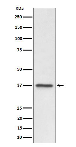 1 - Anti-C3orf38 Rabbit Monoclonal Antibody ABO16407
