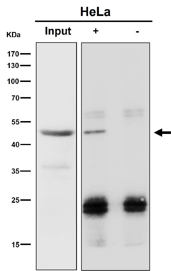 1 - Anti-RBMXL2 Rabbit Monoclonal Antibody ABO16412