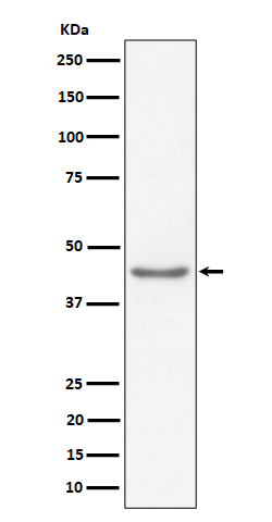 1 - Anti-RBMXL2 Rabbit Monoclonal Antibody ABO16412