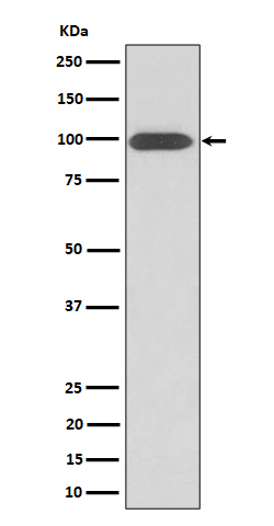 1 - Anti-Integrin beta 3 / CD61 Rabbit Monoclonal Antibody ABO16413