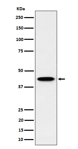 1 - Anti-ITPK1 Rabbit Monoclonal Antibody ABO16414
