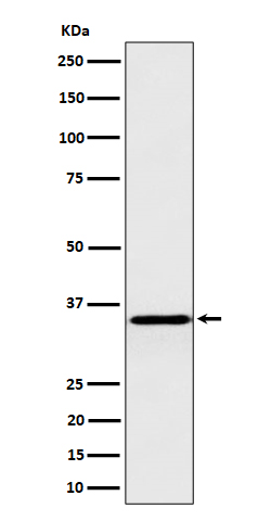 1 - Anti-Pyrophosphatase 1 Rabbit Monoclonal Antibody ABO16418