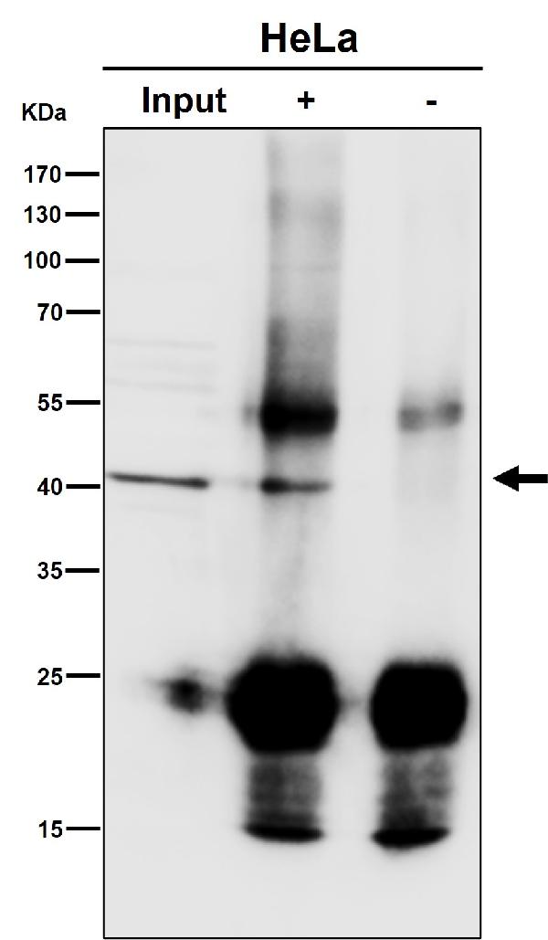 1 - Anti-ACAT1 Rabbit Monoclonal Antibody ABO16419