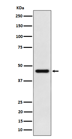 1 - Anti-ACAT1 Rabbit Monoclonal Antibody ABO16419