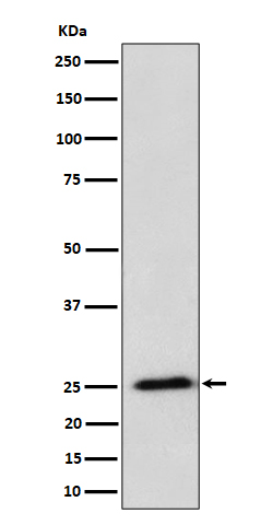 1 - Anti-RPL10A Rabbit Monoclonal Antibody ABO16420